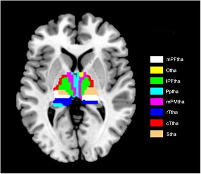 Abnormal dynamic functional connectivity of thalamic subregions in patients with first-episode, drug-naïve major depressive disorder